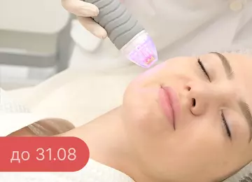 Микроигольчатый RF-лифтинг Vivace